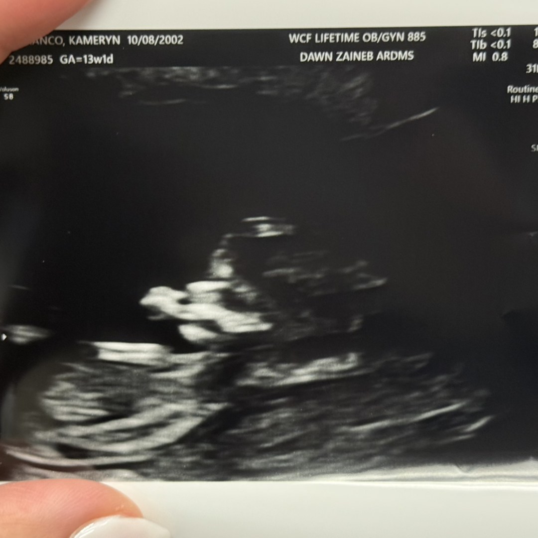 Photo shared by Kameryn for their Babylist baby registry.