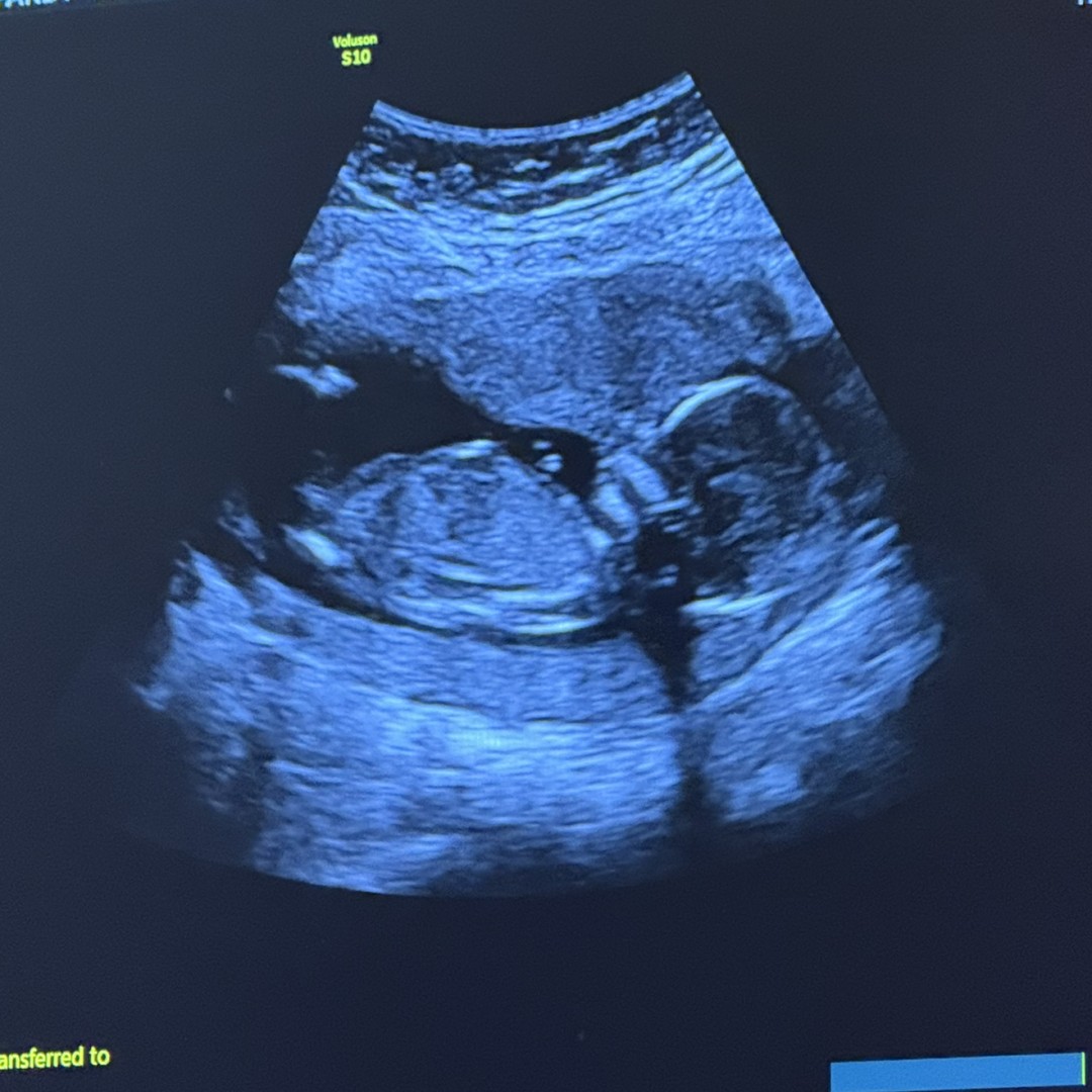 Photo shared by Taylor for their Babylist baby registry.