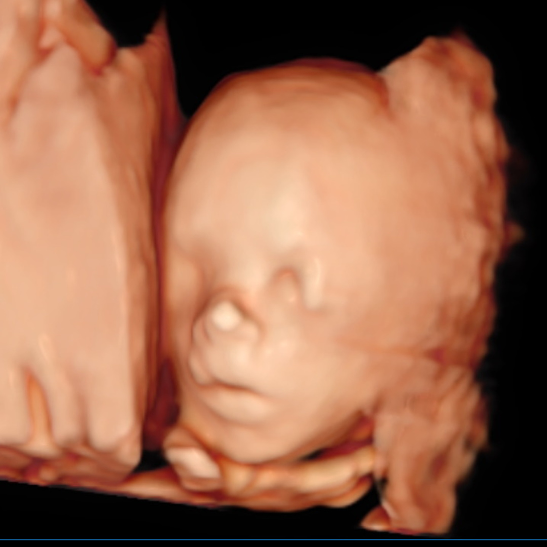 Photo shared by Julia for their Babylist baby registry.