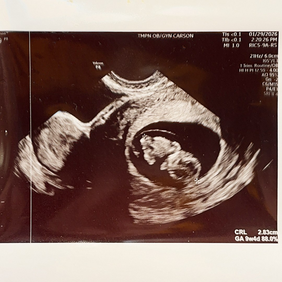 Photo shared by Alix for their Babylist baby registry.