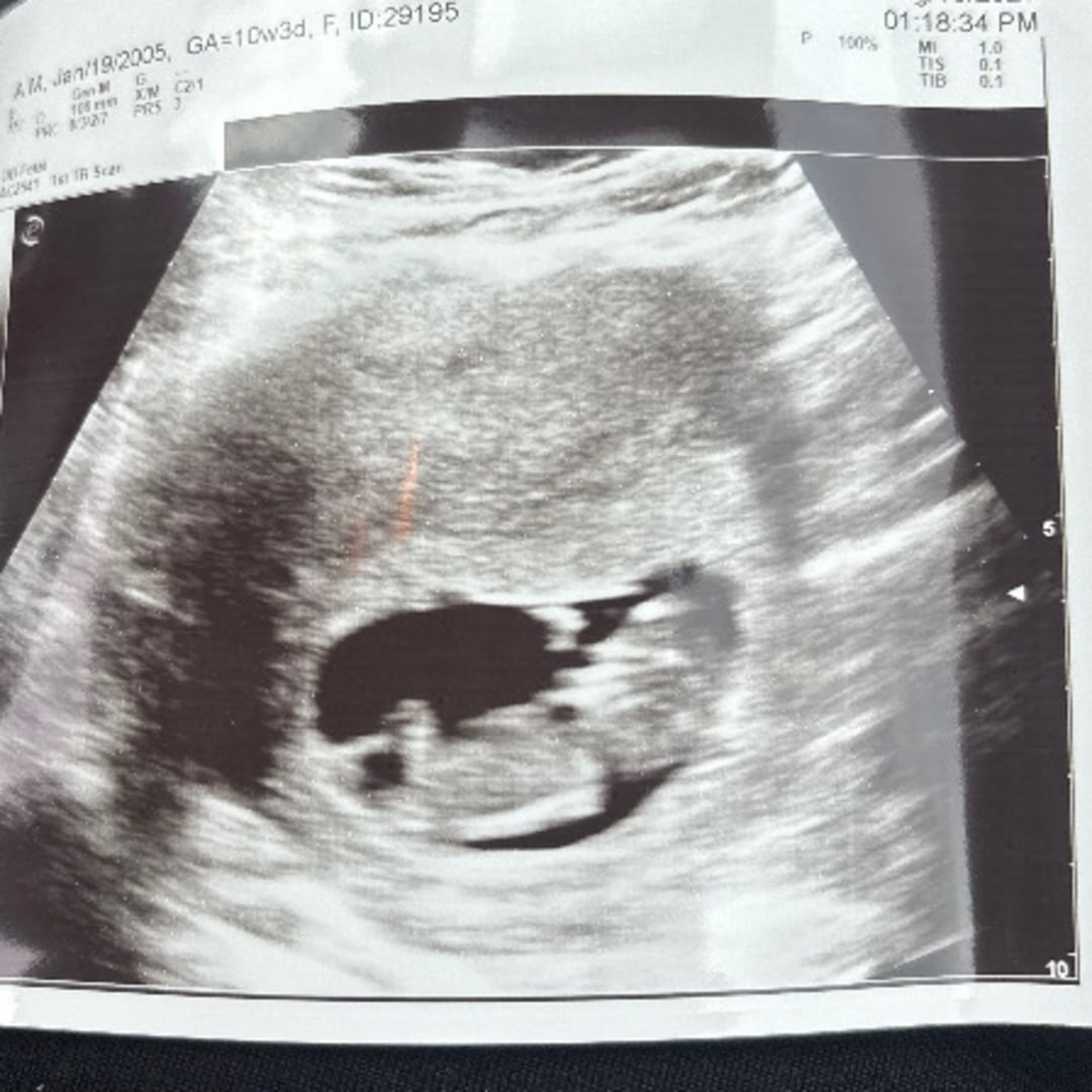 Photo shared by Michelle for their Babylist baby registry.