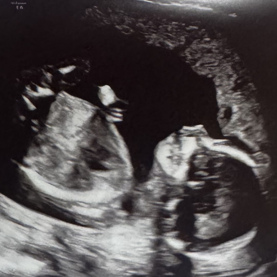 Photo shared by Sonya for their Babylist baby registry.