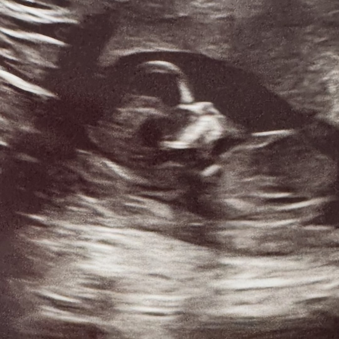 Photo shared by Emilia for their Babylist baby registry.