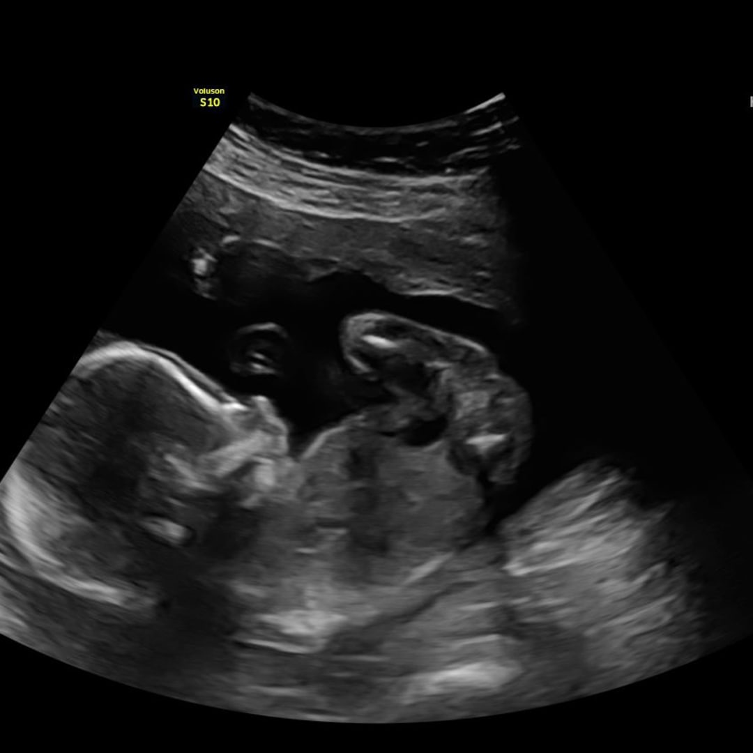 Photo shared by Jessica for their Babylist baby registry.