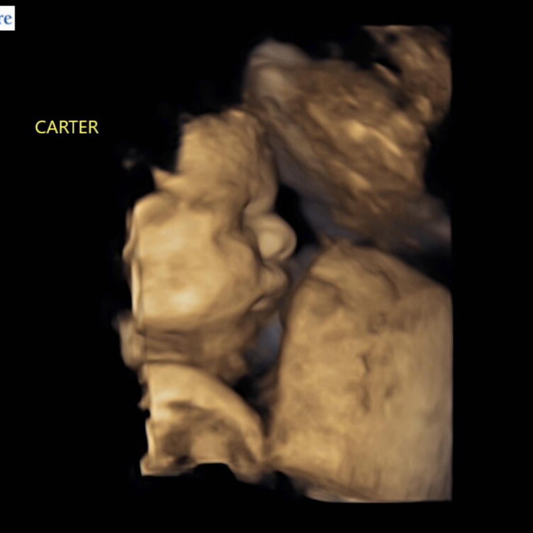 Photo shared by Emily for their Babylist baby registry.