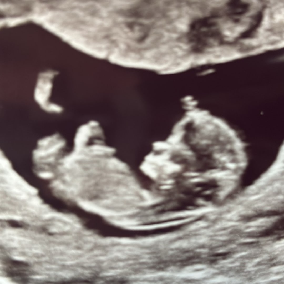 Photo shared by Allayne for their Babylist baby registry.