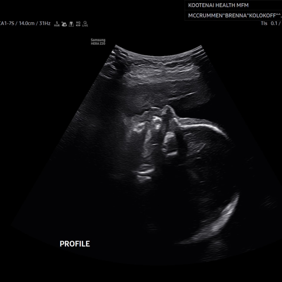 Photo shared by Emberly for their Babylist baby registry.