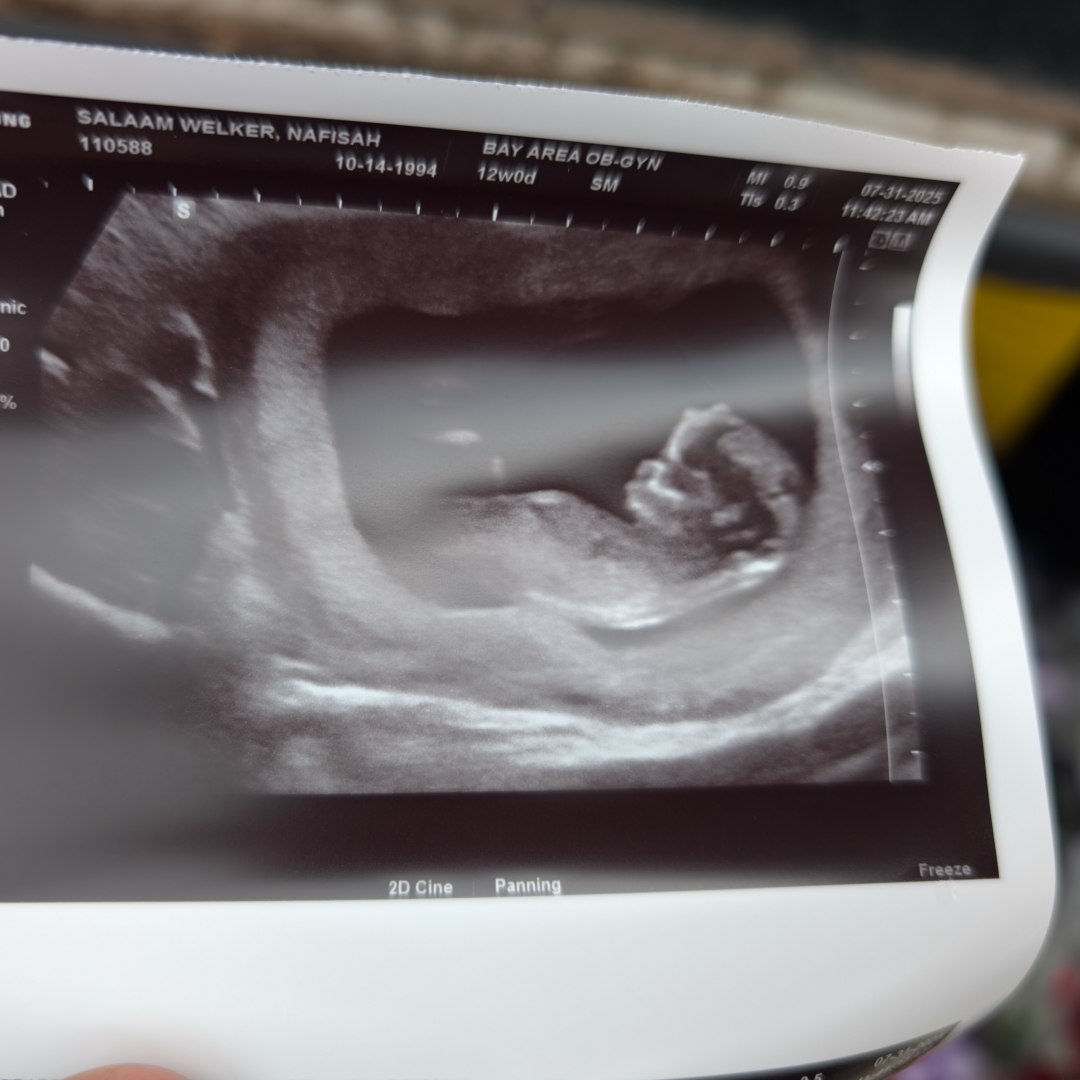 Photo shared by Nafisah for their Babylist baby registry.