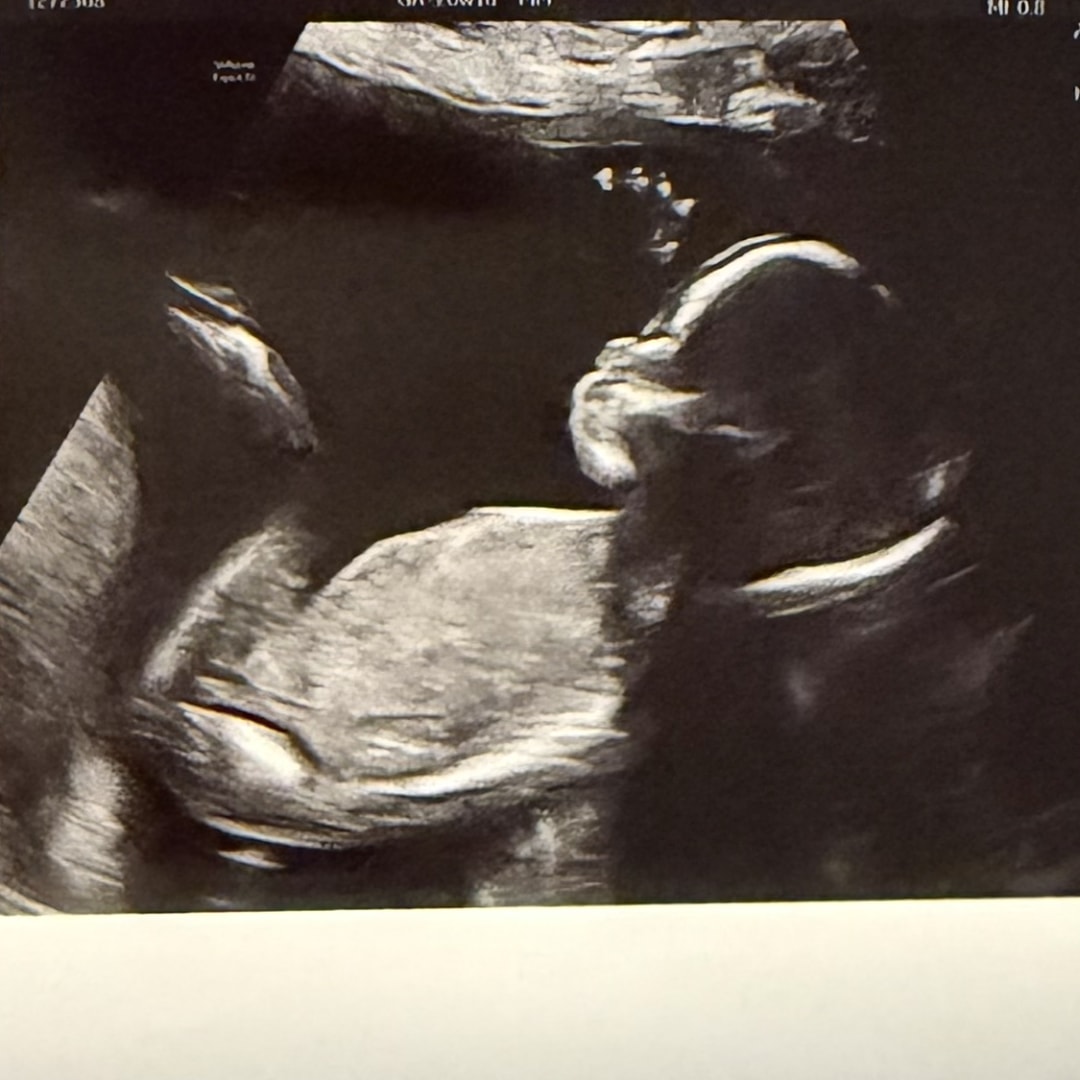 Photo shared by Stephanie for their Babylist baby registry.