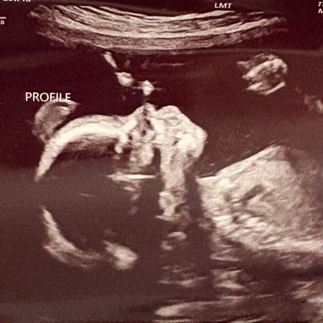 Photo shared by Lexie for their Babylist baby registry.