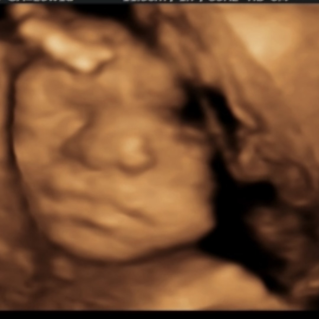 Photo shared by Cheyenne for their Babylist baby registry.