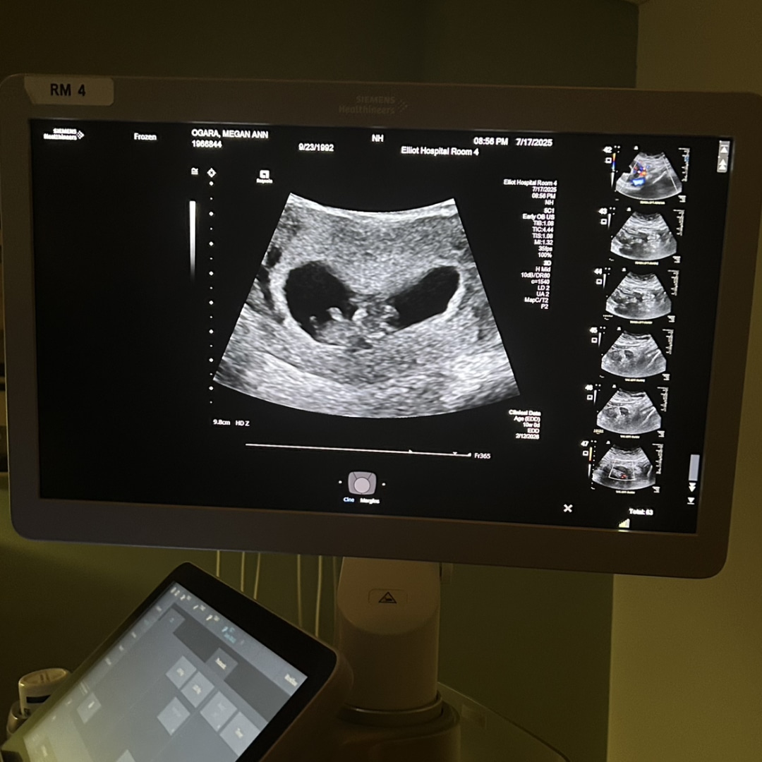 Photo shared by Megan for their Babylist baby registry.