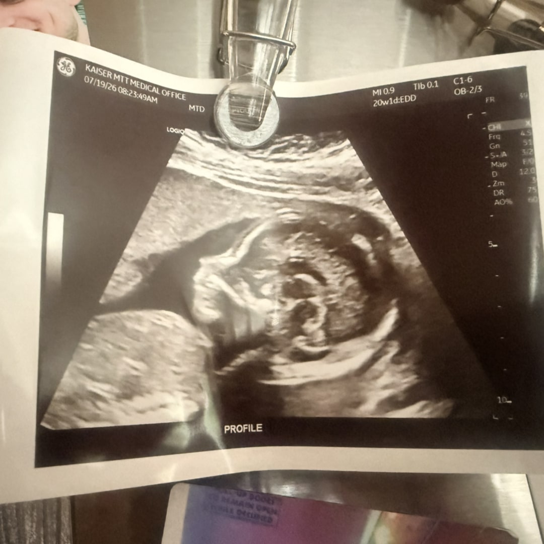 Photo shared by Aileen for their Babylist baby registry.