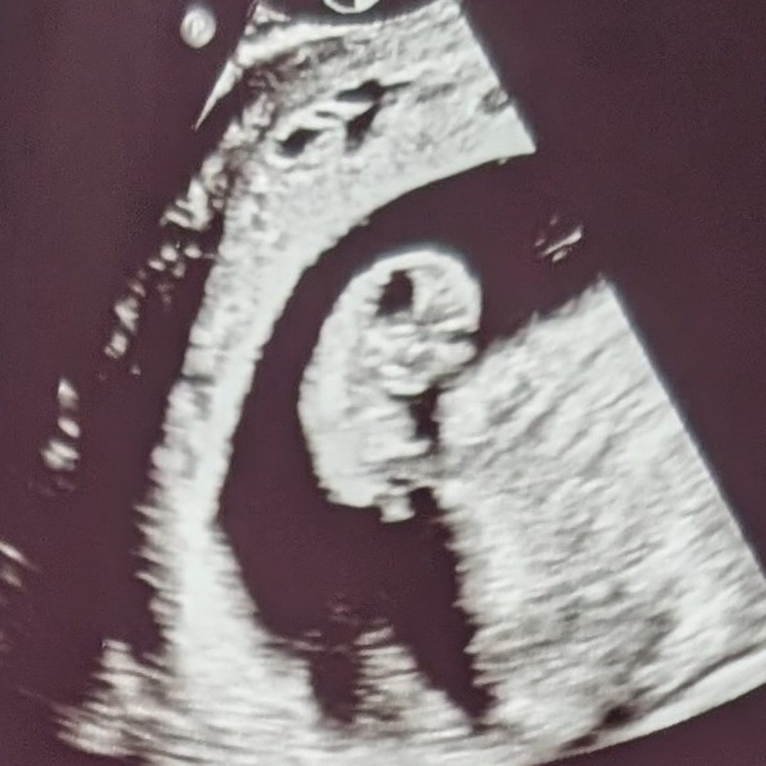 Photo shared by Avril for their Babylist baby registry.