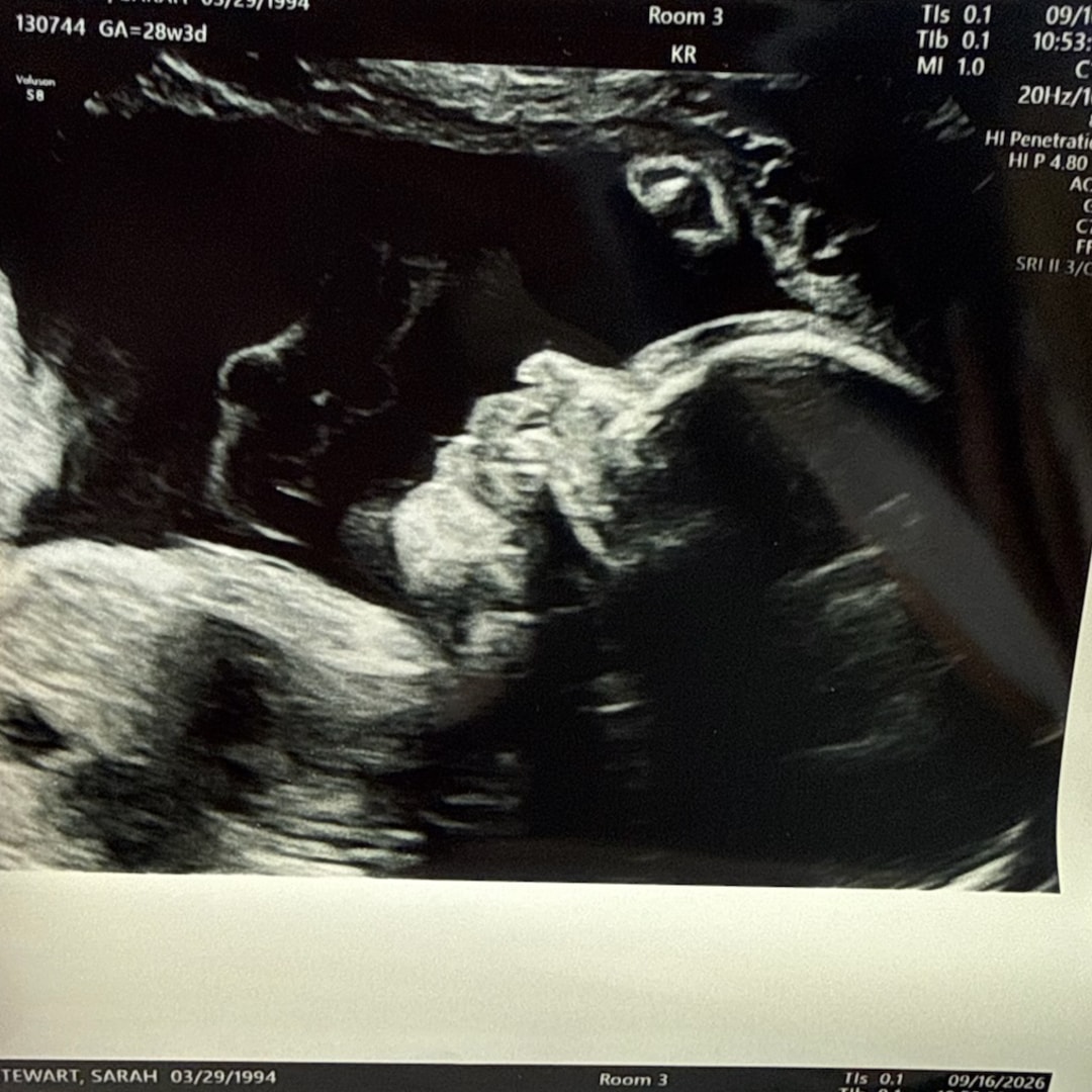 Photo shared by Sarah for their Babylist baby registry.