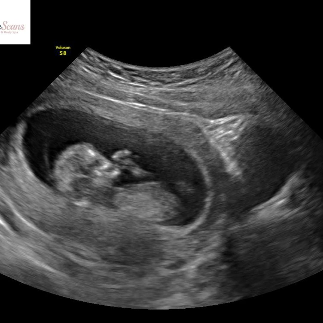 Photo shared by Avery for their Babylist baby registry.