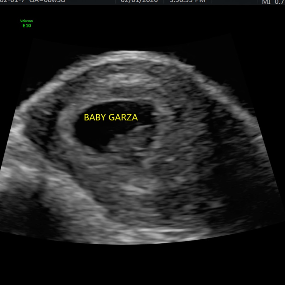 Photo shared by Emycelin for their Babylist baby registry.