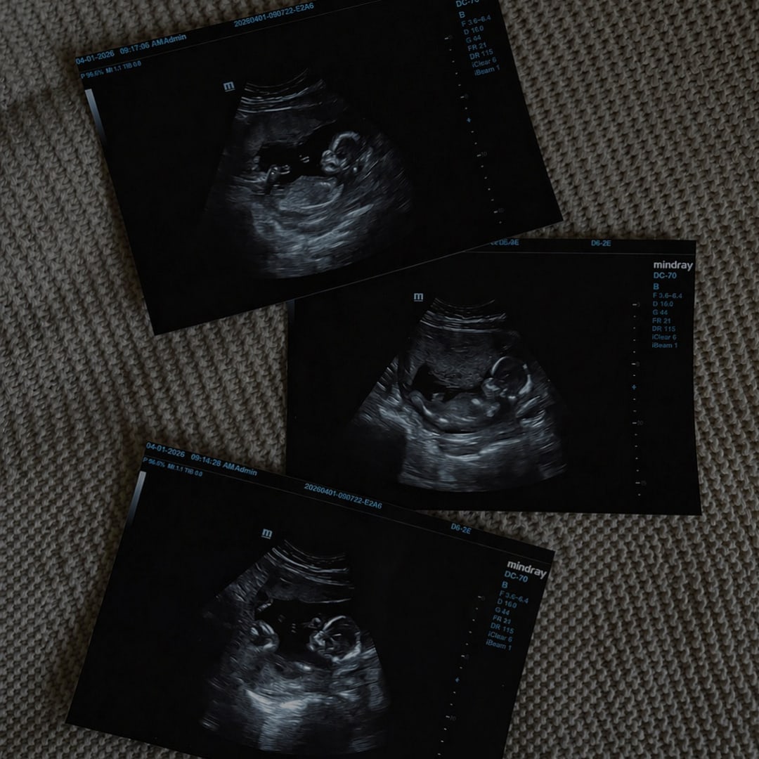 Photo shared by Jaiden for their Babylist baby registry.