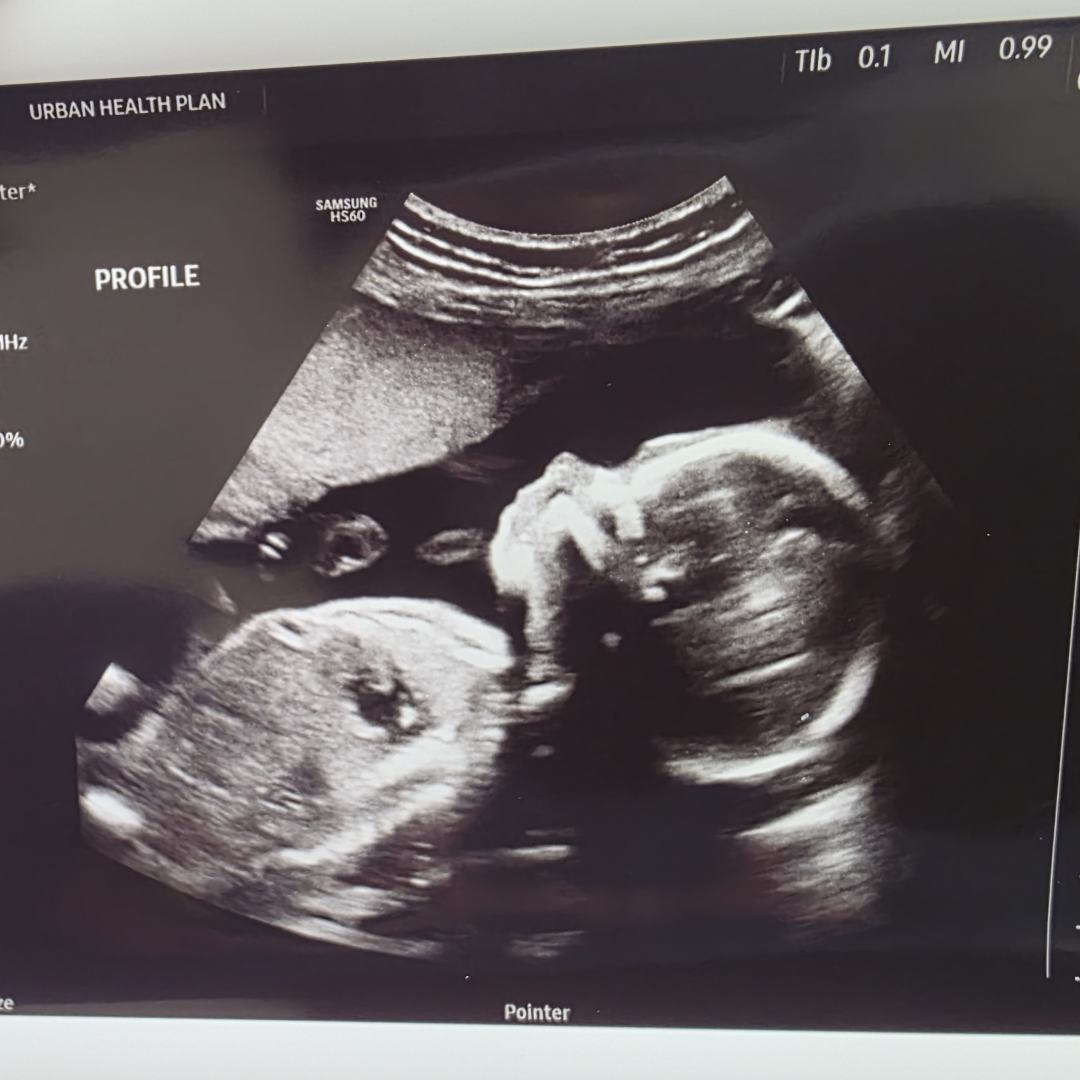Photo shared by Jasmin for their Babylist baby registry.