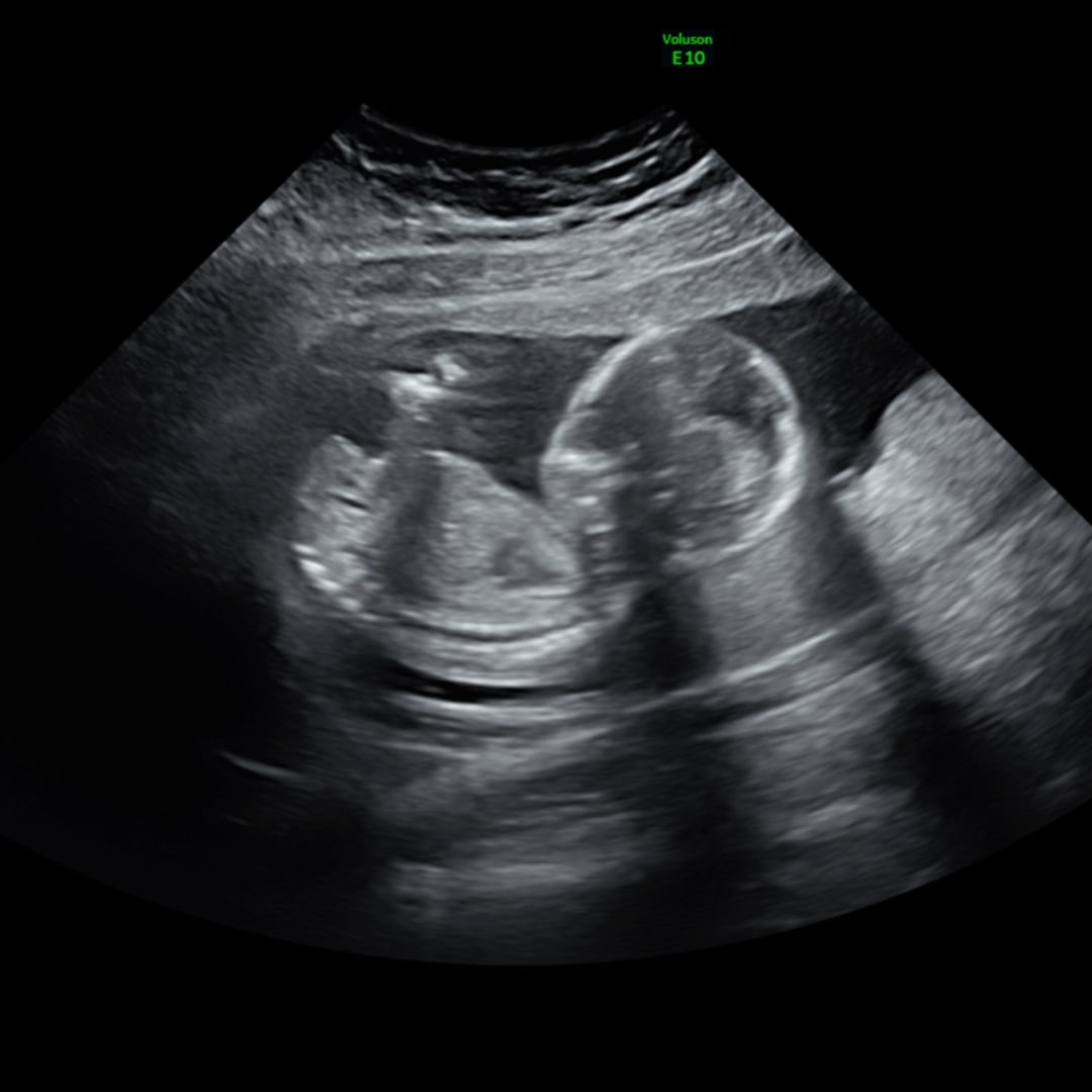 Photo shared by Ellie for their Babylist baby registry.
