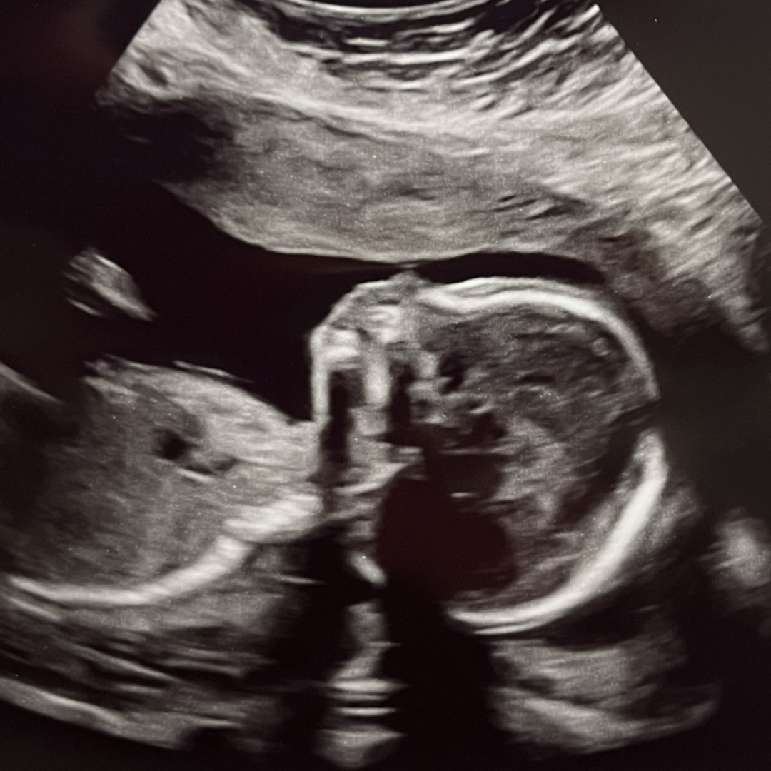 Photo shared by Melanie for their Babylist baby registry.