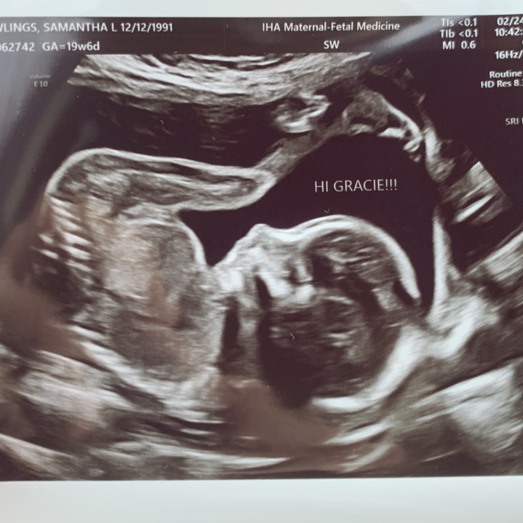 Photo shared by Sam for their Babylist baby registry.