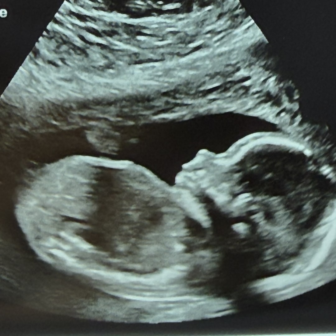 Photo shared by Ashley for their Babylist baby registry.