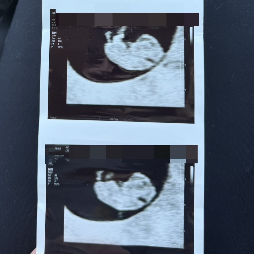 Photo shared by Erica for their Babylist baby registry.