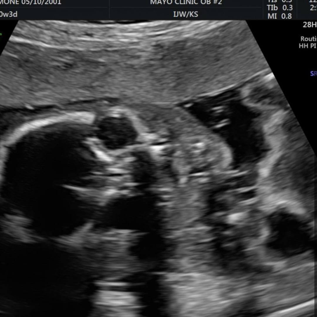 Photo shared by Ava for their Babylist baby registry.