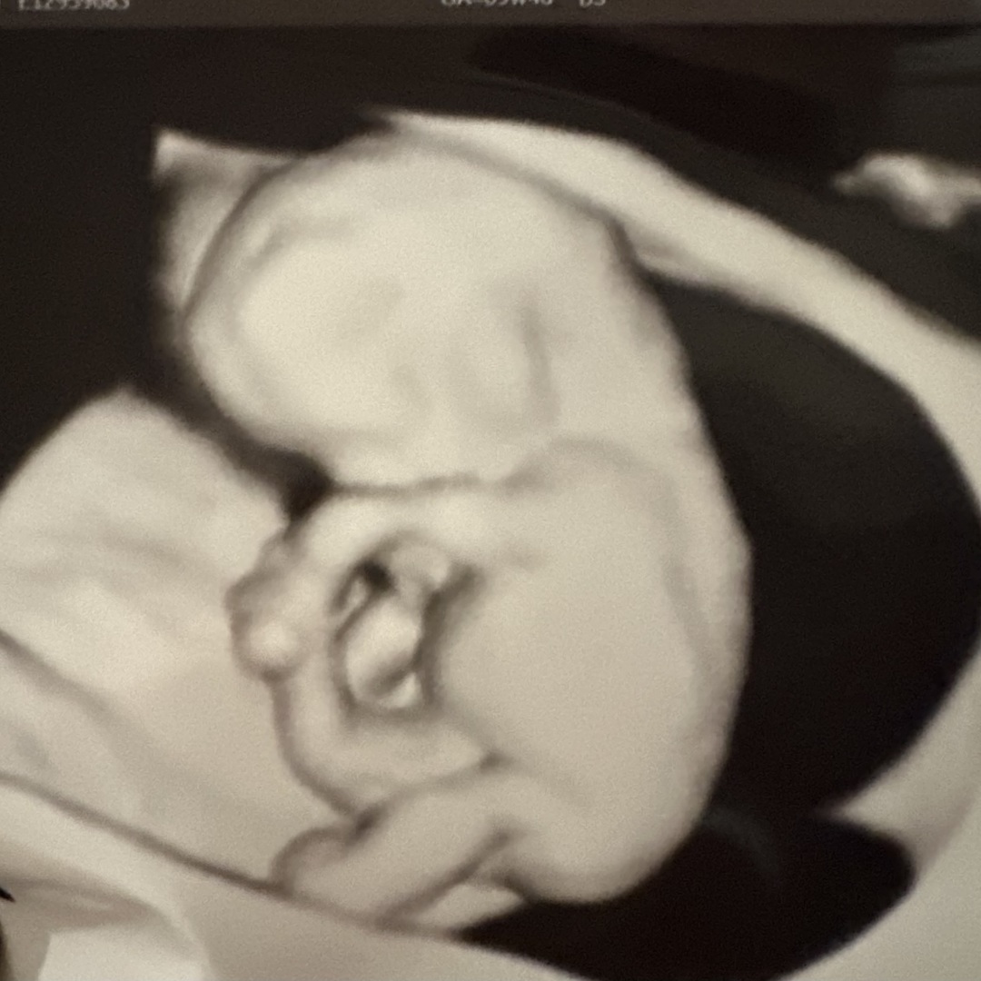 Photo shared by Annah for their Babylist baby registry.