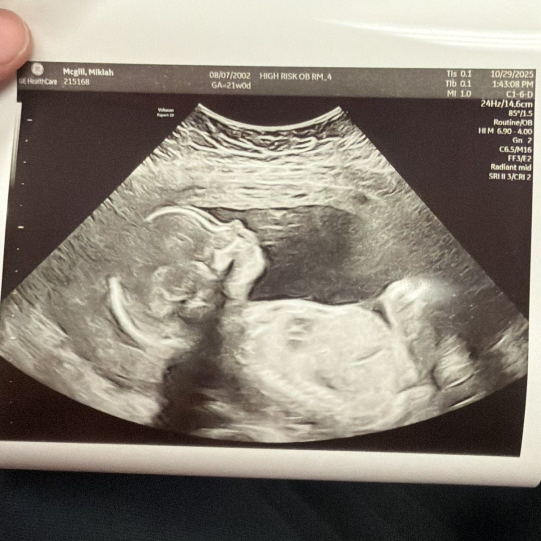 Photo shared by Mikiah for their Babylist baby registry.