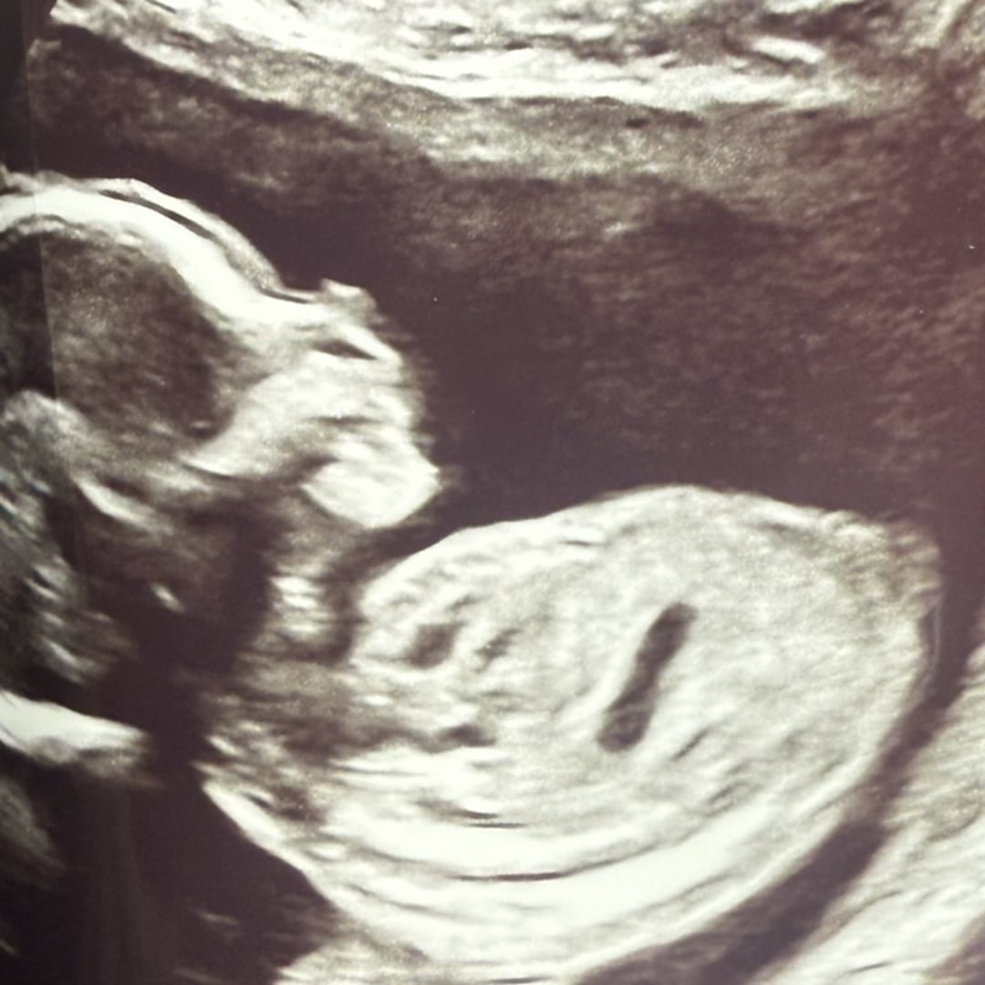 Photo shared by Jasmyn for their Babylist baby registry.