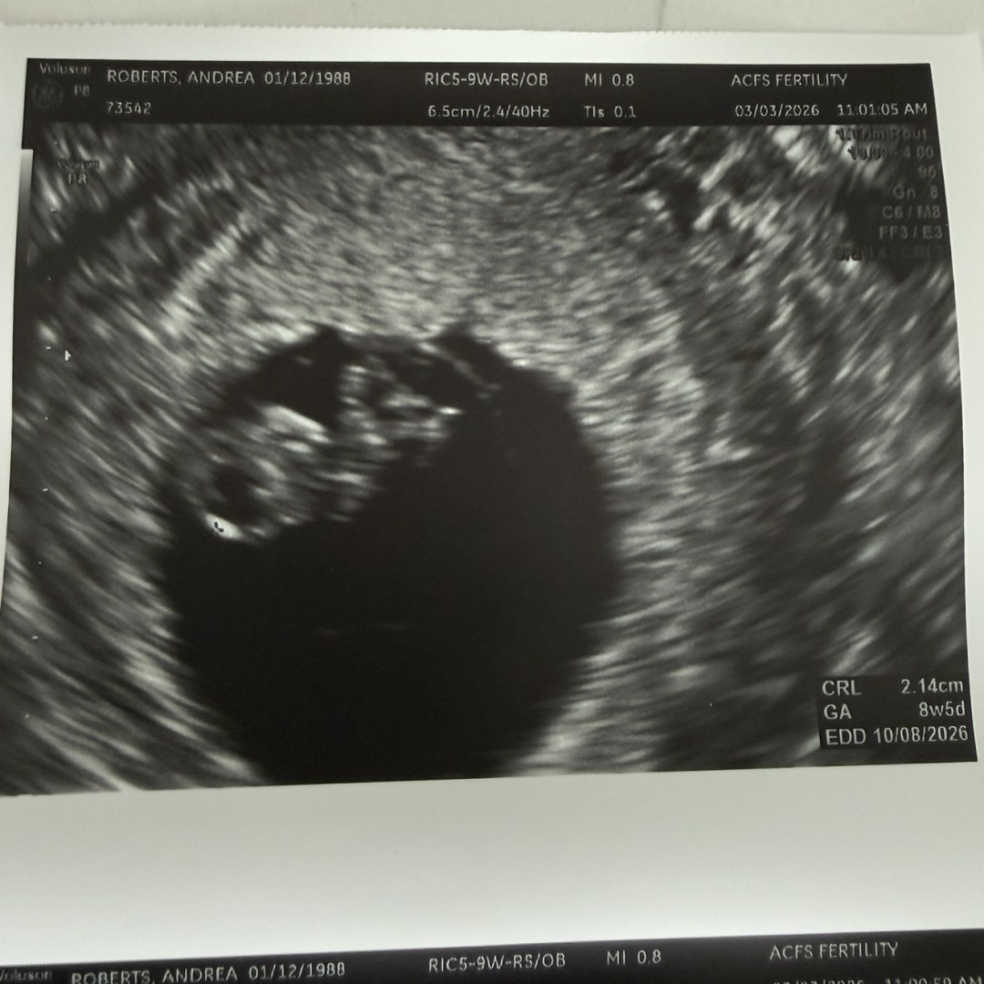 Photo shared by Andrea for their Babylist baby registry.