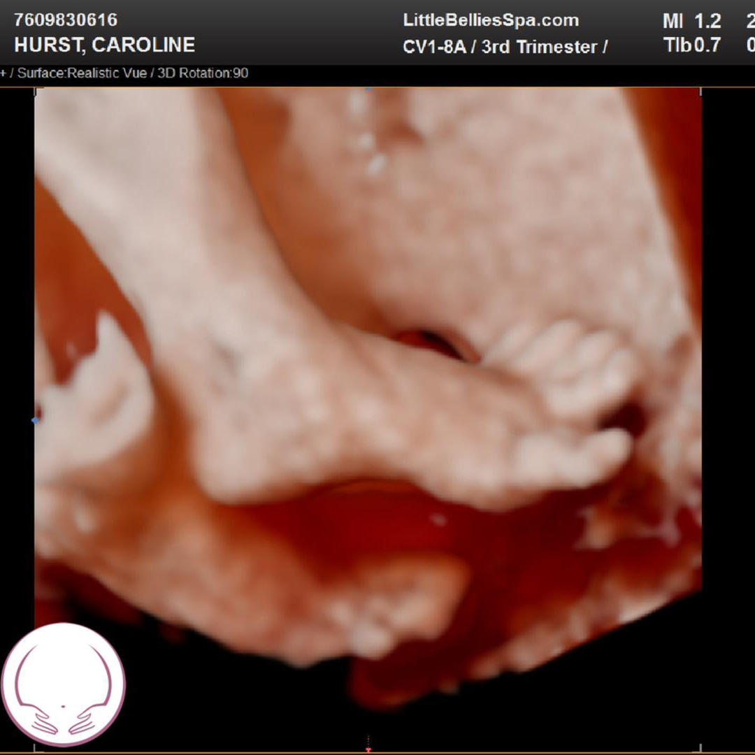 Photo shared by Caroline for their Babylist baby registry.