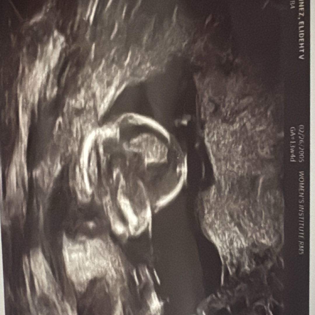 Photo shared by Elideht for their Babylist baby registry.