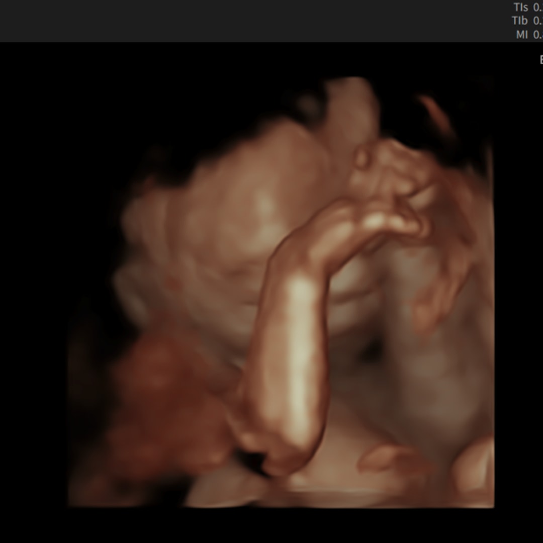 Photo shared by Connie for their Babylist baby registry.