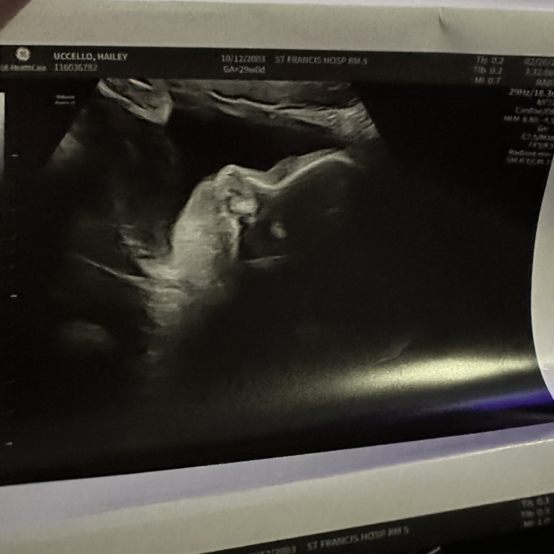 Photo shared by Hailey for their Babylist baby registry.