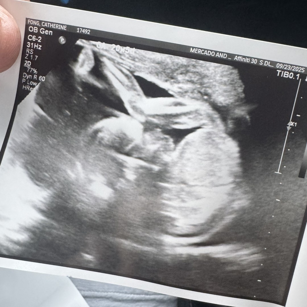 Photo shared by Catherine for their Babylist baby registry.