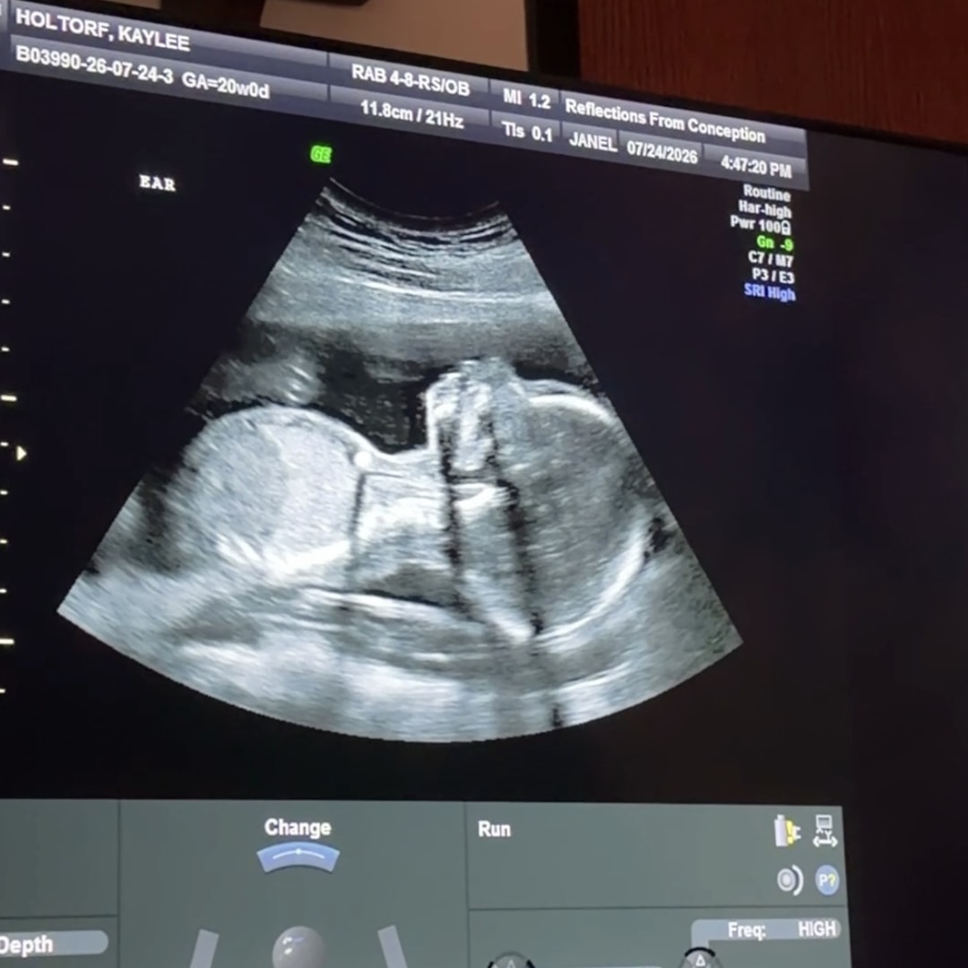 Photo shared by Kaylee for their Babylist baby registry.