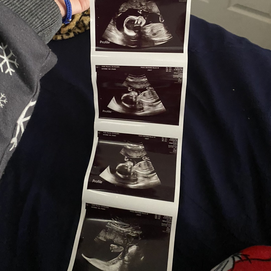 Photo shared by Norma for their Babylist baby registry.