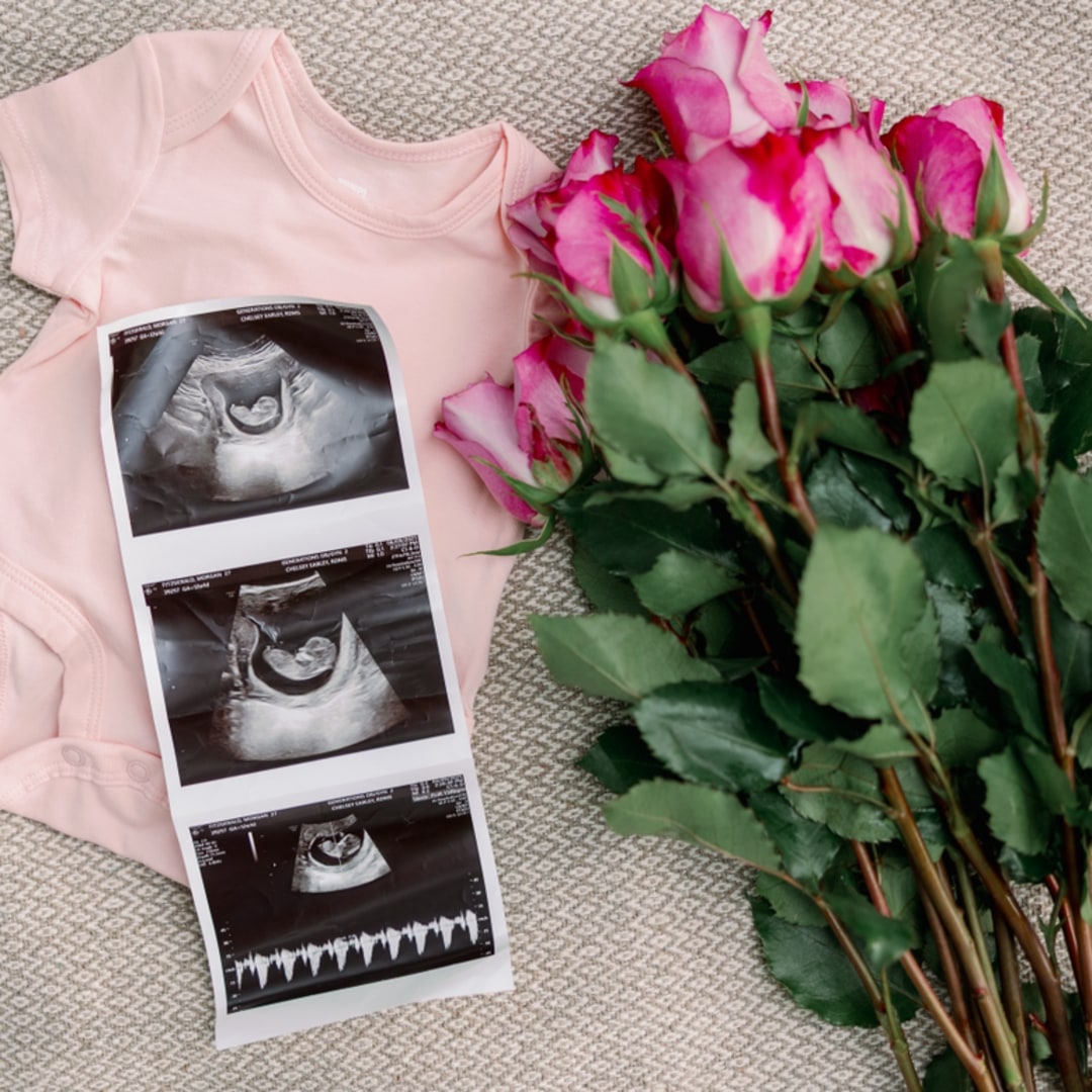 Photo shared by Morgan for their Babylist baby registry.