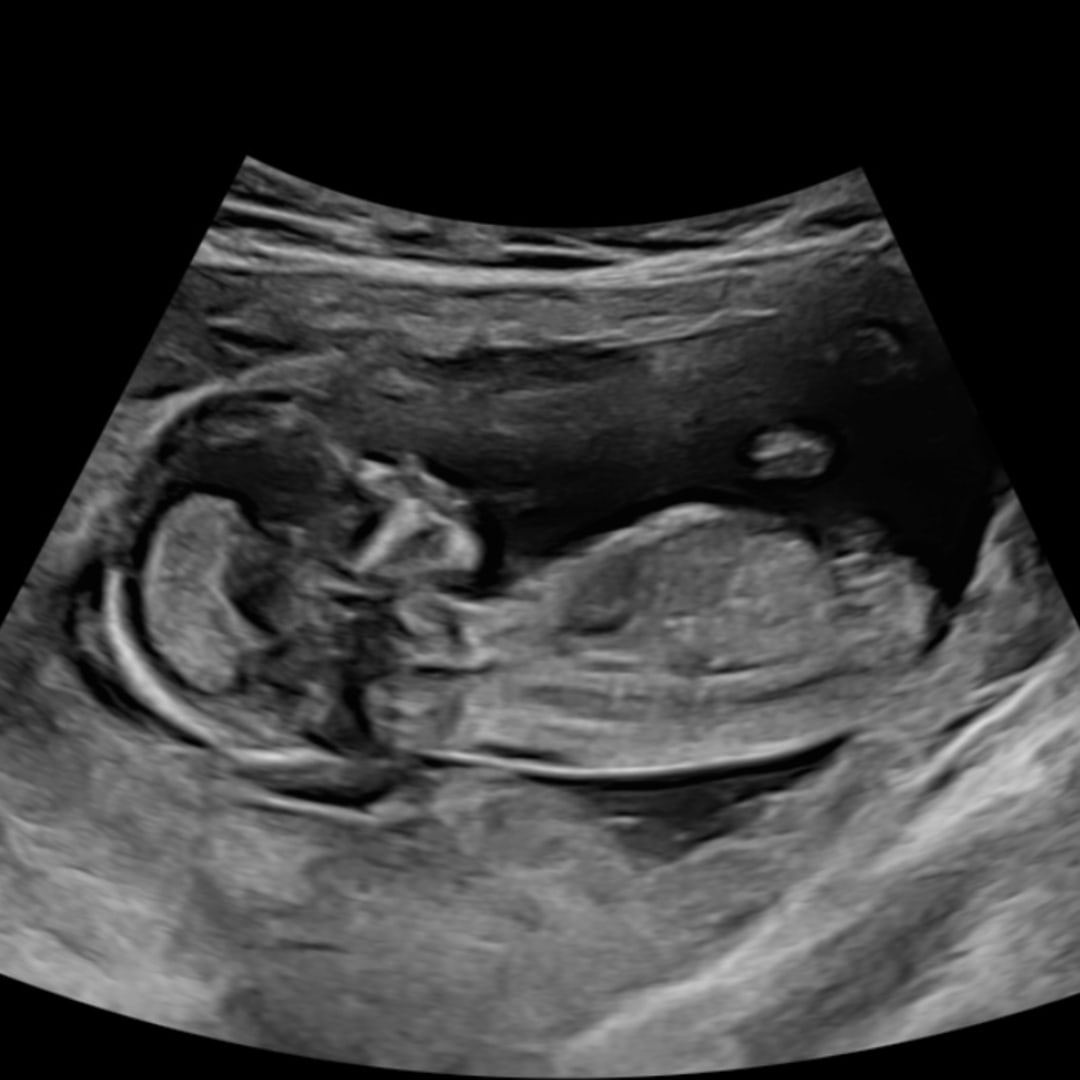 Photo shared by Angelita for their Babylist baby registry.