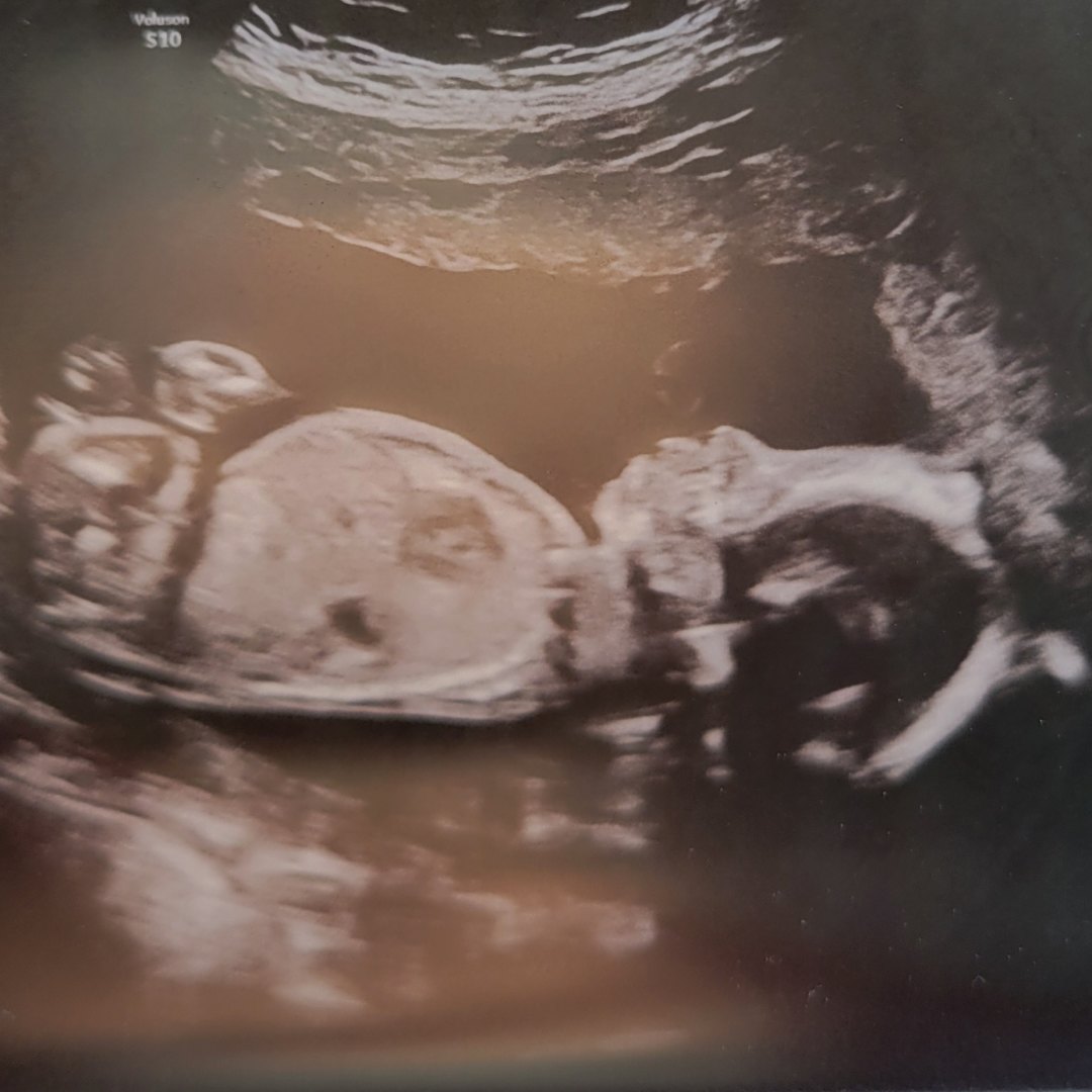 Photo shared by Jenni for their Babylist baby registry.