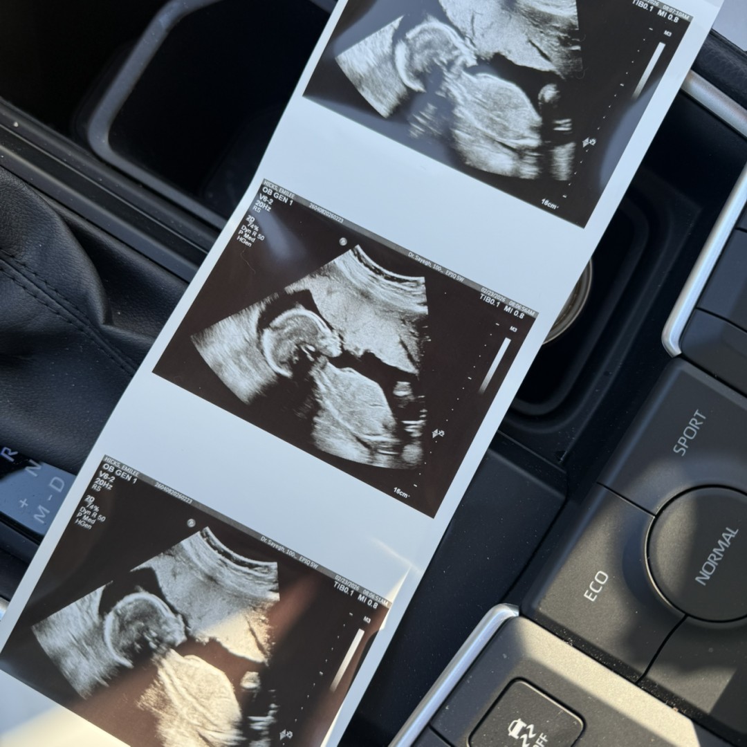 Photo shared by Emilee for their Babylist baby registry.