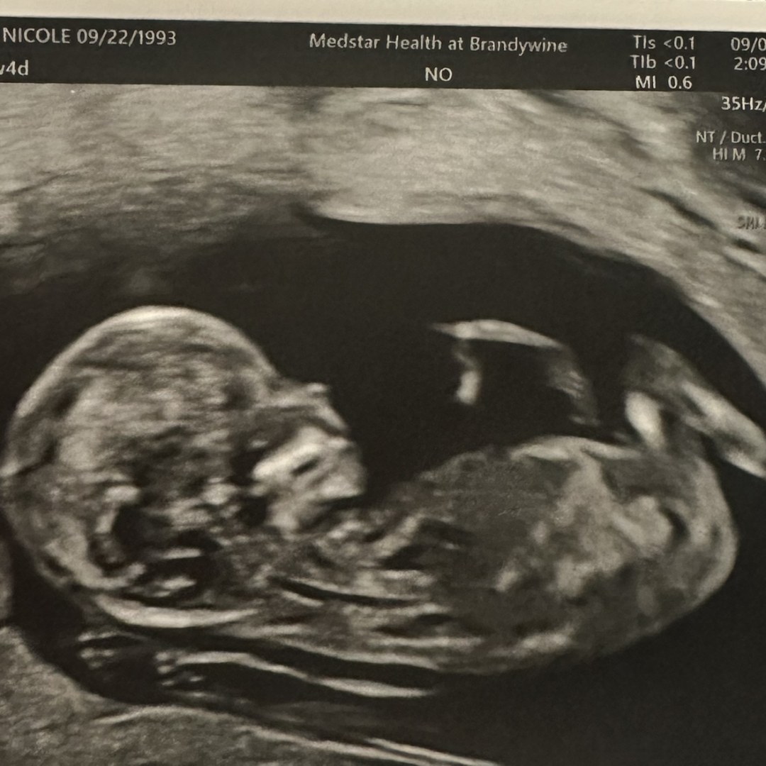 Photo shared by Breanne for their Babylist baby registry.