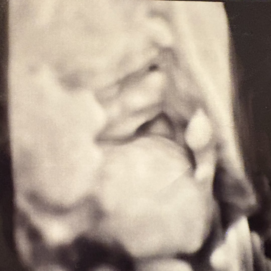 Photo shared by Destiny for their Babylist baby registry.