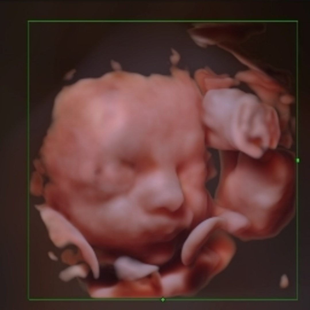 Photo shared by Sarah for their Babylist baby registry.