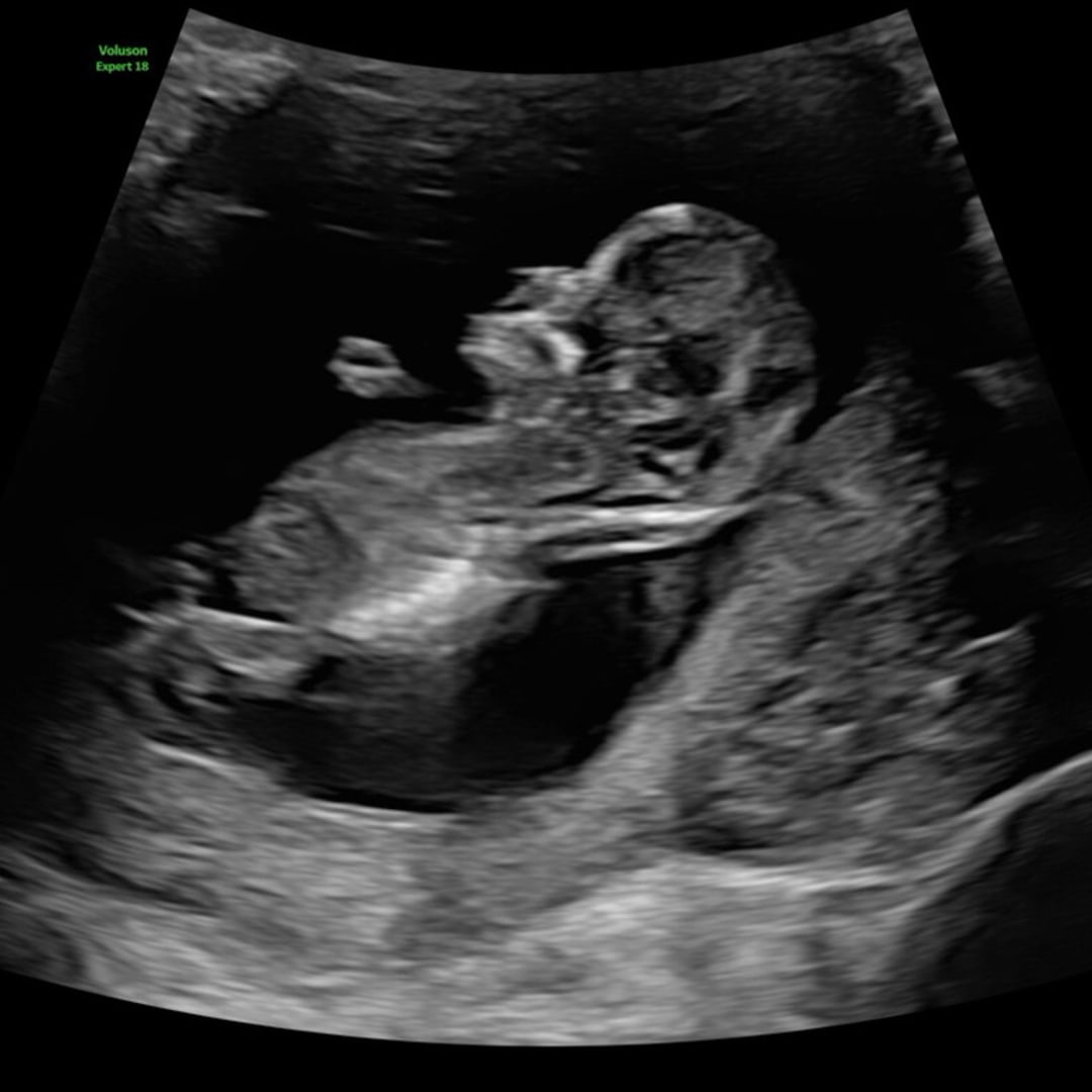 Photo shared by Chana for their Babylist baby registry.