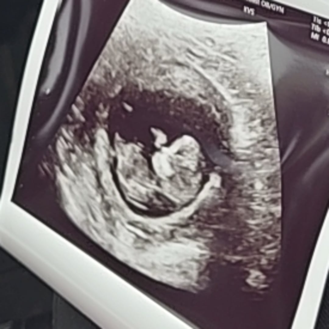 Photo shared by Amanda for their Babylist baby registry.