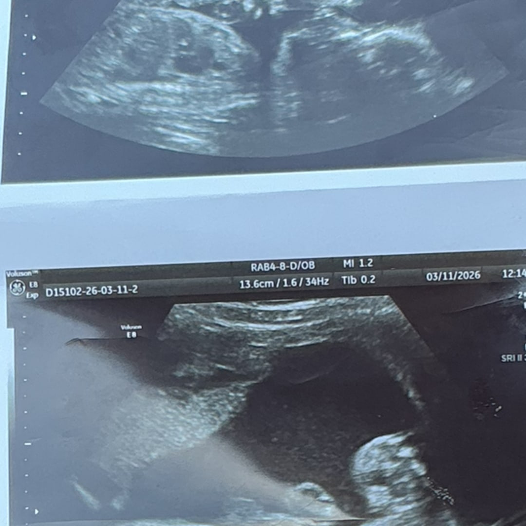 Photo shared by Dream for their Babylist baby registry.